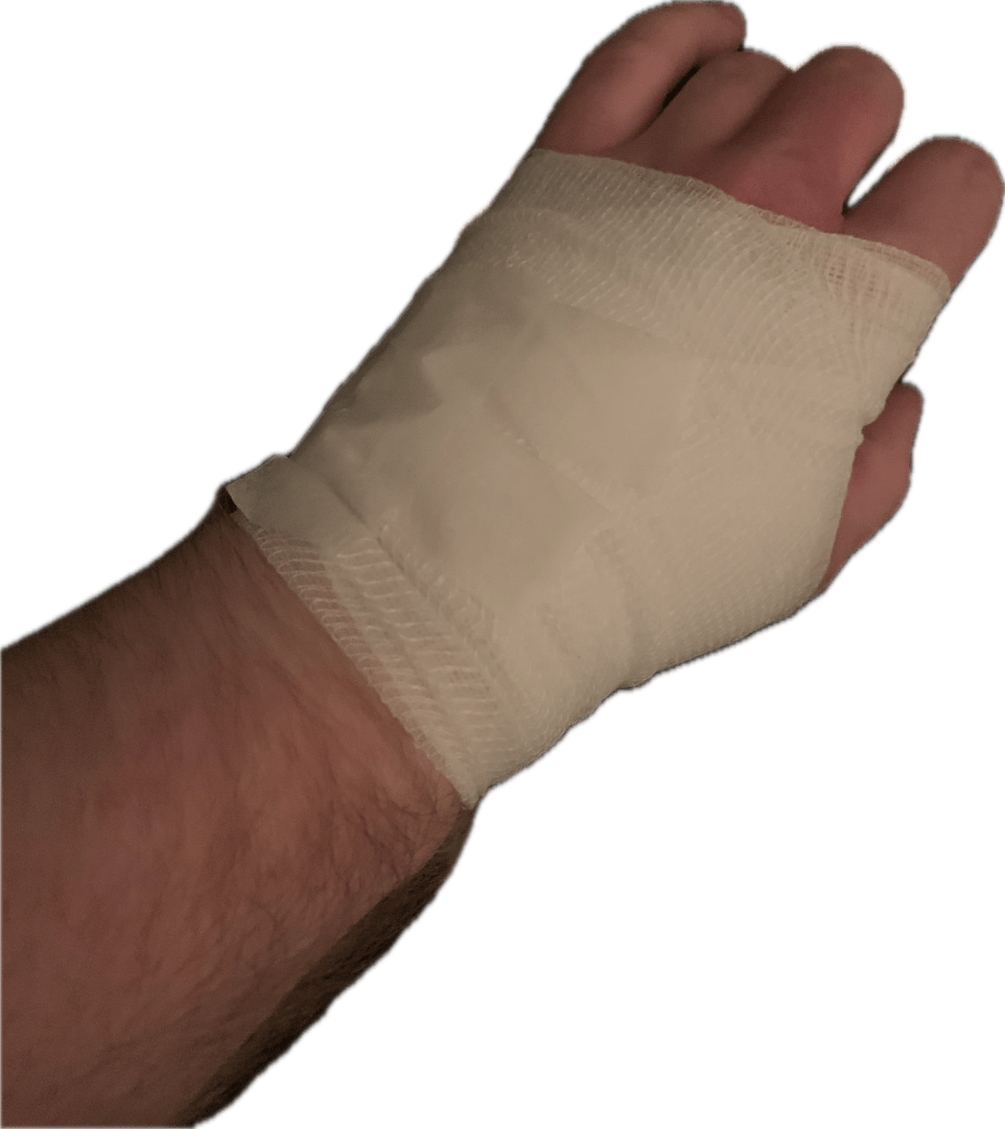 Auf dem Bild ist meine Hand zu sehen in einer Bandage Man könnte meinen, dass es eine Band agierte Hand eines Boxers ist aufgrund der Haltung meiner Hand. Aber leider nein.